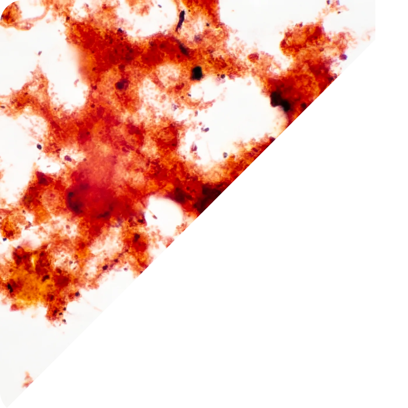 Mikroskopický snímek kalu po aplikaci – zlepšená struktura